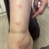 https://cdn-ostrovok-ru-ion.test.edgekey.net/t/100x100/hotel_review/62/5c/625cdc5cbc704b3dc62fdb2141d44d3561baa5e2.JPEG
